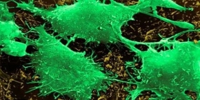 Naukowcy: organizm może sam zwalczać raka
